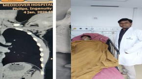 बच्चे को अचानक शुरू हुई खांसी, CT Scan में सामने आई ऐसी भयानक तस्वीर doctors remove a bulb from 9 year old boy lungs in hyderabad telangana - News Nation
